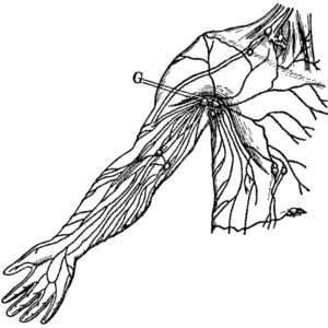 imagen del sistema linfático en su recorrido por el brazo